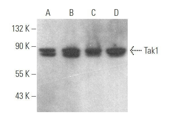 その他 aggggn tak1-antibody-h-5-western-