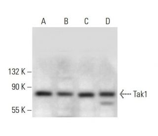 western blotting image from recommended Tak1 (C-9) monoclonal antibody replacement. Image 376150