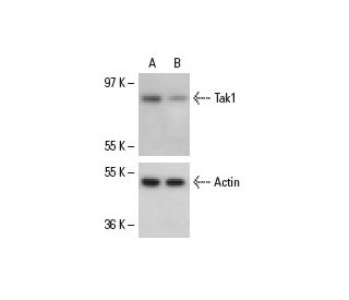 Tak1 siRNA (h): sc-36606. Western blot analysis of Tak1 expression in non-transfected control (A) and Tak1 siRNA transfect 