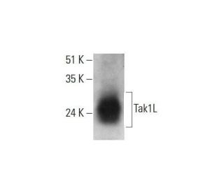 Tak1L Antibody (G-8) - Western Blotting - Image 348614SAM Transcription Activation: SAM system utilizing dCas9-VP64, MS2-P65-HSF1, and sgRNA for precise gene transcription activation.