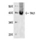 TAL1 Antibody (2TL242) - Western Blotting - Image 14325 