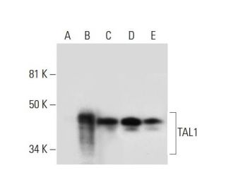 TAL1 Antibody (B-8) - Western Blotting - Image 294517