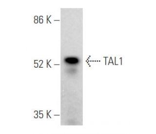 western blotting image from recommended TAL1 (C-4) monoclonal antibody replacement. Image 354668