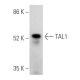 western blotting image from recommended TAL1 (C-4) monoclonal antibody replacement. Image 354668
