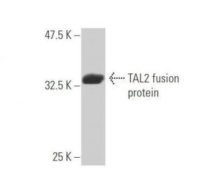 TAL2 Antibody (1G6) - Western Blotting - Image 348861