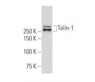 Talin-1 Antibody (YQ-16) - Western Blotting - Image 33458 