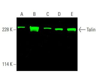 Talin Antibody (C-9) - Western Blotting - Image 378832