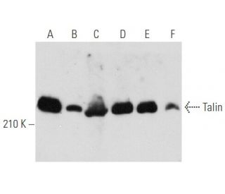 western blotting image from recommended Talin (C-9) monoclonal antibody replacement. Image 354737