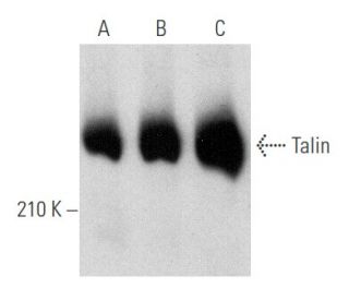 Talin Antibody (TA205) - Western Blotting - Image 354739 