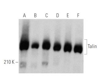 Talin Antibody (TLN01 [TA205]) - Western Blotting - Image 354740 