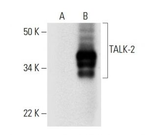 TALK-2 Antibody (A-5) - Western Blotting - Image 294827