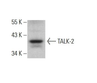 TALK-2 Antibody (F-6) - Western Blotting - Image 378502 