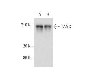 TANC Antibody (H-8) - Western Blotting - Image 325136Each CRISPR/Cas9 Knockout (KO) Plasmid product consists of a pool of 3 plasmids designed to ensure identification and cleavage of a specific gene for maximum knockout efficiency. Each plasmid encodes a unique 20 nt sequence derived from the GeCKO (v2) library.