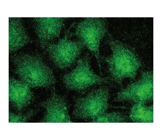 Tankyrase-1/2抗体(E-10) | SCBT - Santa Cruz Biotechnology