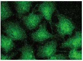 Tankyrase-1/2 Antibody (E-10) | SCBT - Santa Cruz Biotechnology