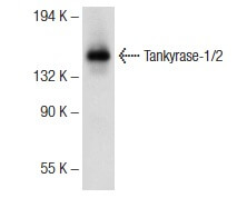 りのページ tankyrase-1-2-antibody-e-10-