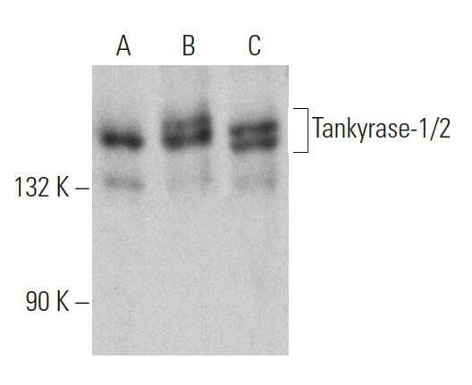 Tankyrase-1/2 Antibody (E-10): sc-365897