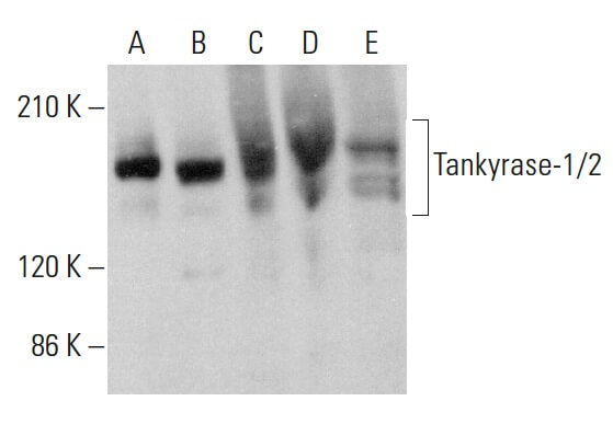 P様　専 tankyrase-1-2-antibody-e-10-