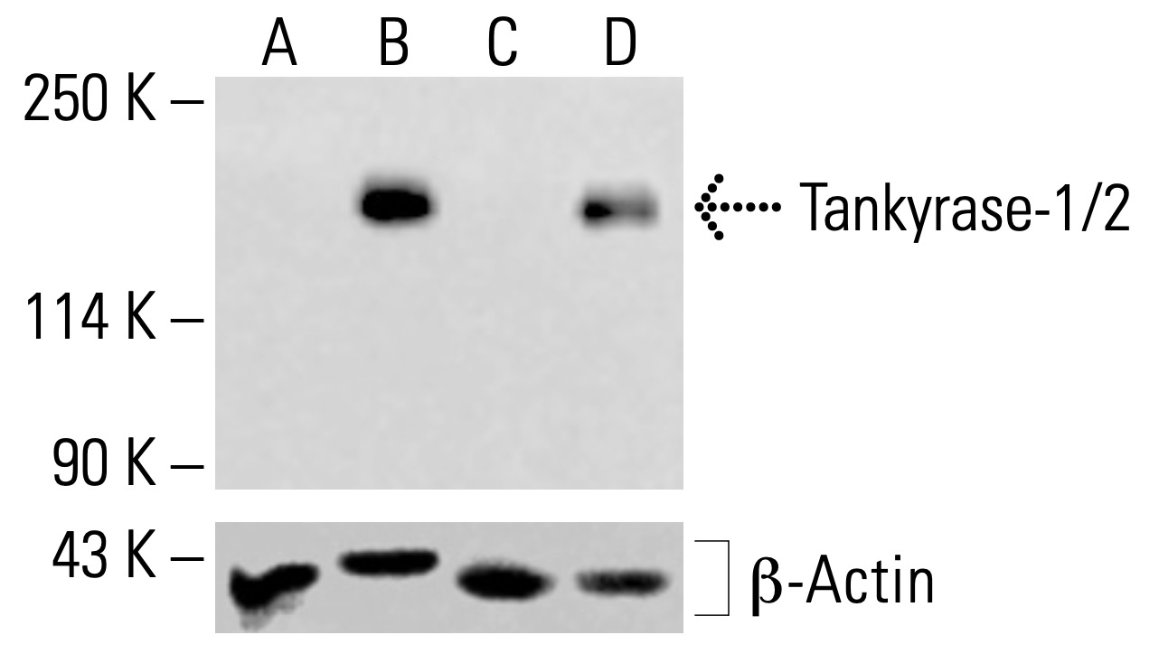 Tankyrase-1/2 Antibody (E-10) | SCBT - Santa Cruz Biotechnology