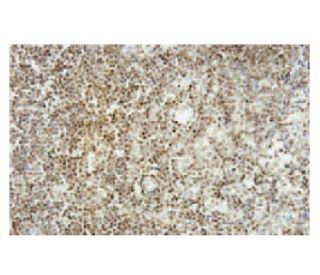Tankyrase-1 Antibody (BL-2) - Immunohistochemistry - Image 53922