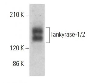 Tankyrase-1/2 Antibody (E-10) - Western Blotting - Image 359672