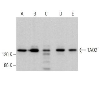 TAO2 Antibody (C-2) - Western Blotting - Image 368363 