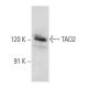 TAO2 Antibody (H-8) - Western Blotting - Image 356950