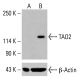 TAO2 Antibody (H-8) - Western Blotting - Image 415613 