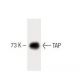 TAP Antibody (31) - Western Blotting - Image 60467 