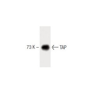 TAP Antibody (31) - Western Blotting - Image 60467