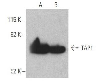 TAP1 Antibody (D-11) - Western Blotting - Image 397375