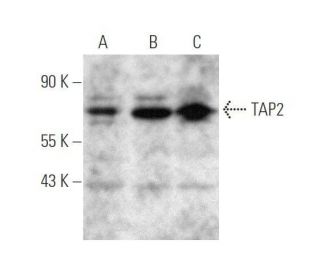 TAP2 Antibody (B-2) - Western Blotting - Image 351706The Double Nickase Plasmid features a U6 promoter for sgRNA expression, a 20 nt targeting sequence, and a gRNA scaffold to guide Cas9n. It includes a CBh promoter for Cas9n (D10A) and puromycin resistance, GFP for transfection verification, and nuclear localization signals (NLS). The 2A peptide allows co-expression of Cas9n and Puro from a single promoter, enabling precise genome editing with reduced off-target effects.