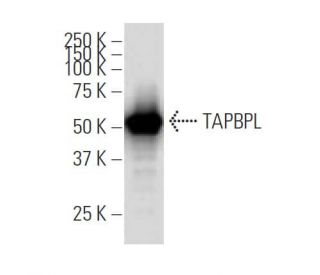 TAPBPL Antibody (42-L) - Western Blotting - Image 33664SAM Transcription Activation: SAM system utilizing dCas9-VP64, MS2-P65-HSF1, and sgRNA for precise gene transcription activation.