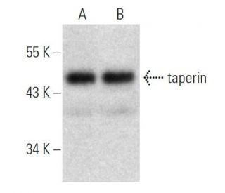 taperin Antibody (H-4) - Western Blotting - Image 368025 