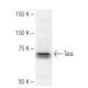 Tara Antibody (2438C1a) - Western Blotting - Image 67377