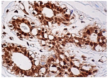 TARDBP Antibody (E-10) | SCBT - Santa Cruz Biotechnology