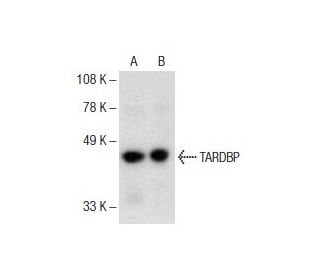 TARDBP Antibody (E-10) | SCBT - Santa Cruz Biotechnology