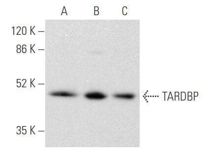 TARDBP Antibody (E-10) | SCBT - Santa Cruz Biotechnology