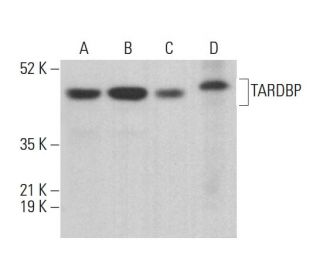 TARDBP Antibody (E-10) - Western Blotting - Image 380762 