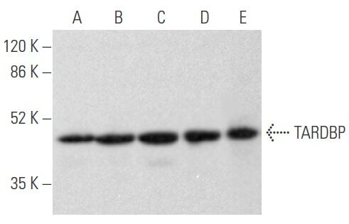 その他 AAcwy TARDBP抗体(H-8) | SCBT - Santa Cruz Biotechnology