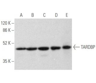 TARDBP Antibody (H-8) - Western Blotting - Image 355466