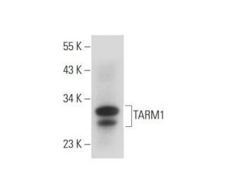 TARM1 Antibody (B-4) - Western Blotting - Image 318377Each CRISPR/Cas9 Knockout (KO) Plasmid product consists of a pool of 3 plasmids designed to ensure identification and cleavage of a specific gene for maximum knockout efficiency. Each plasmid encodes a unique 20 nt sequence derived from the GeCKO (v2) library.