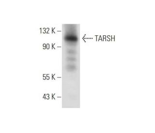TARSH Antibody (H-8) - Western Blotting - Image 309634 