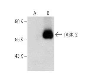 western blotting image from recommended TASK-2 (F-7) monoclonal antibody replacement. Image 137070