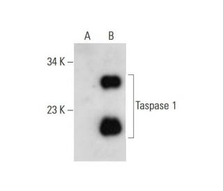 Taspase 1 Antibody (B-7) - Western Blotting - Image 325240