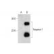 Taspase 1 Antibody (B-7) - Western Blotting - Image 325240