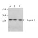 Taspase 1 Antibody (F-7) - Western Blotting - Image 367375