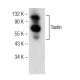 Tastin Antibody (H-1) - Western Blotting - Image 146502 