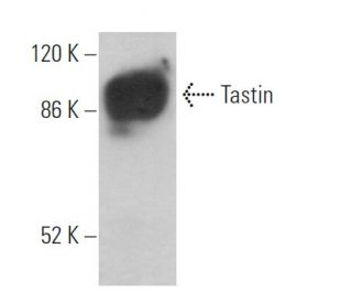Tastin Antibody (H-1) - Western Blotting - Image 372008 