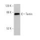 Tastin Antibody (H-1) - Western Blotting - Image 372007